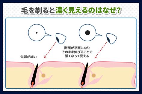 けつ毛はなぜ生えるのか？理由を紹介